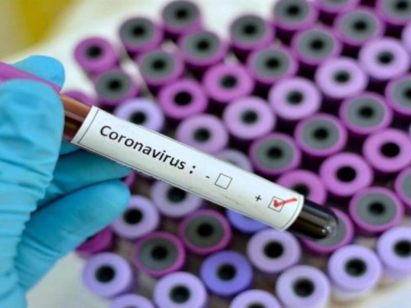 Κατεπείγουσα συνεδρίαση της Οικονομικής Επιτροπής της περιφέρειας Πελοποννήσου για την προμήθεια 5.000 Rapid Test