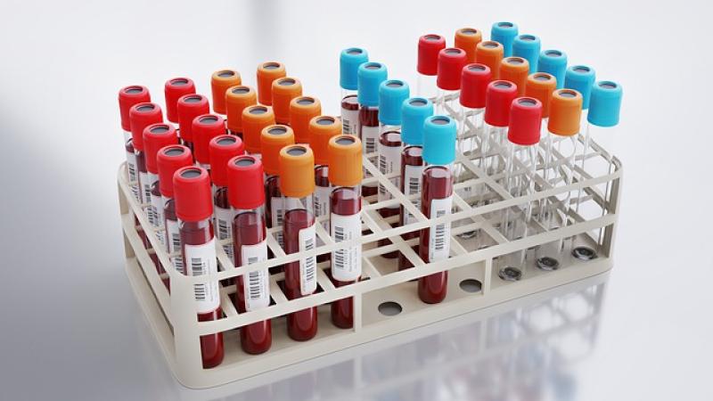 Υγεία: Νέο τεστ αίματος προβλέπει τον κίνδυνο εμφράγματος και εγκεφαλικού με αυξημένη ακρίβεια